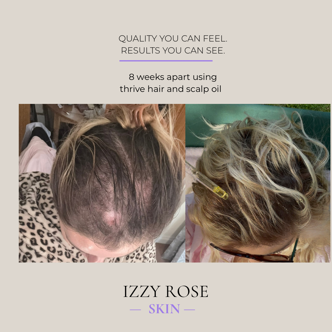 Nighttime routine for scalp, hair + skin.  Replace your 20 products with two that actually work